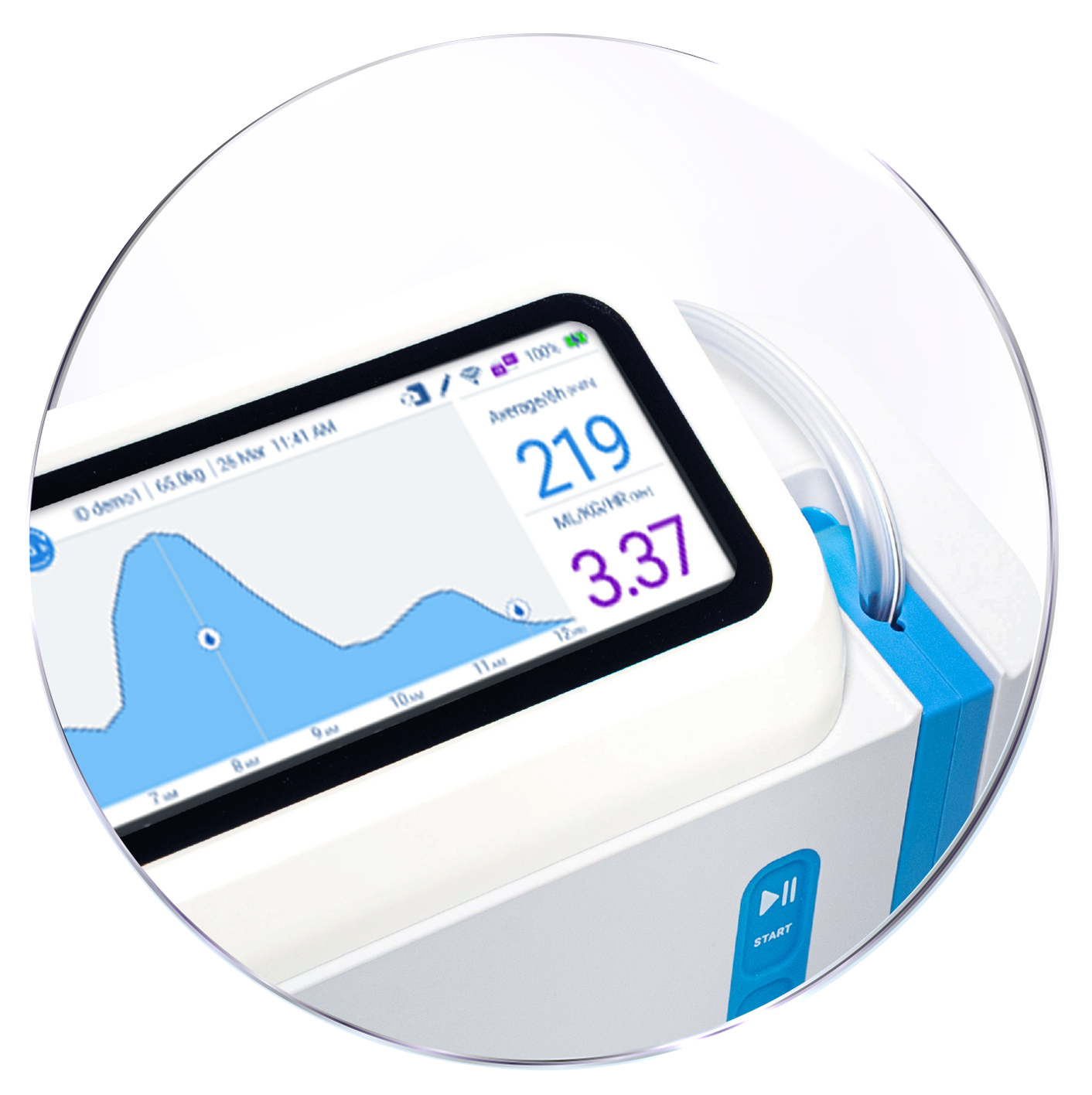 FIZE Medical source image associated with the reported financing